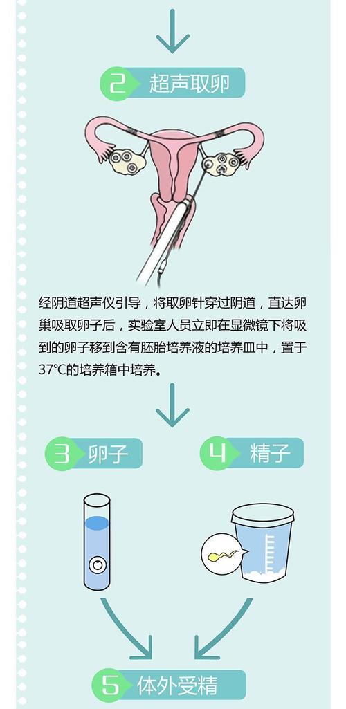 试管代怀的步骤【试管代怀:从备孕到移植,全程步骤详解】